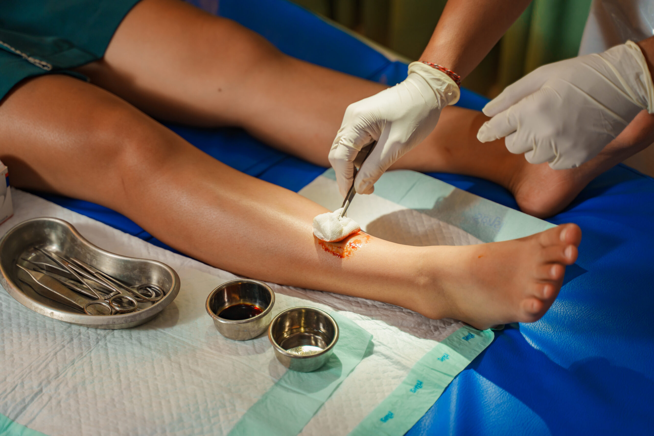 Maha Medicare clinician treating a patient's foot