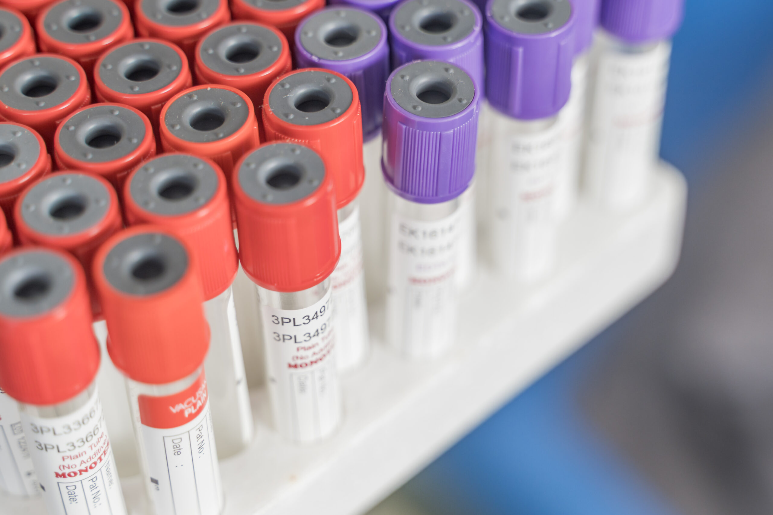 Blood sample tubes in the Maha Medicare laboratory